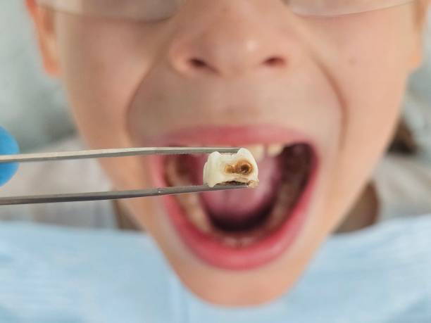 Best Root Canal Emergency Dentist  in Scott Af, IL