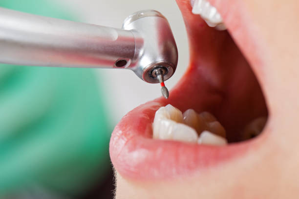  Scott Af, IL Emergency Dentist Pros